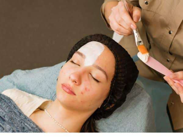 A woman Doing Treatment for Acne