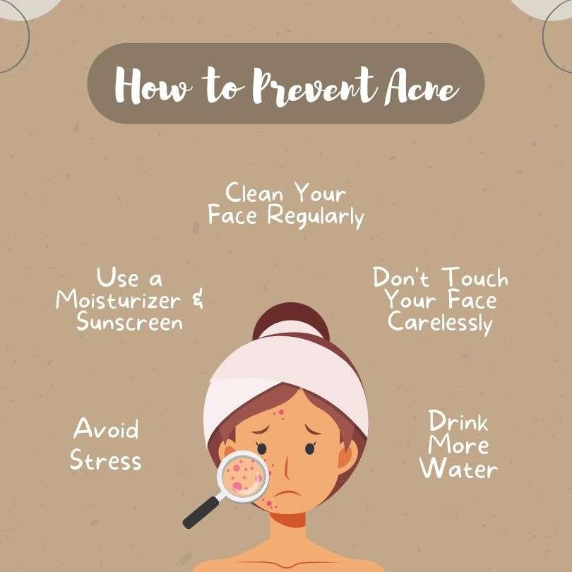 How to Prevent Acne